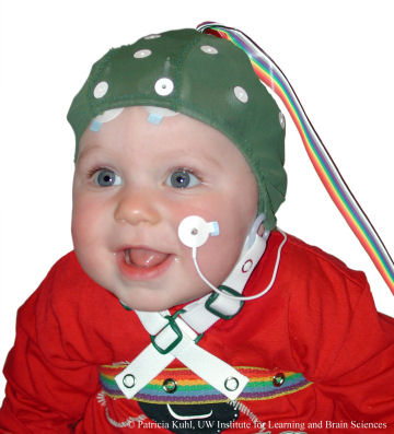 This baby is wearing an electrode capwhich painlessly monitors electrical activity in the brain during experiments.