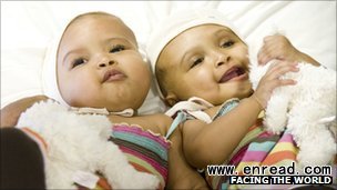The twins do not appear to have suffered neurological side effects as a result of surgery