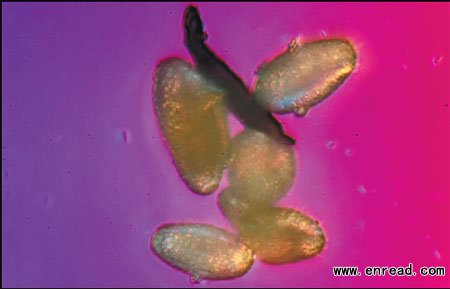 A picture of smog particles under the microscope taken by Zhang Chao