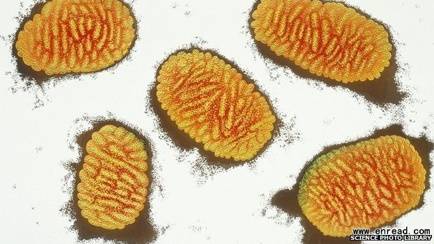 得天花病的人照片
